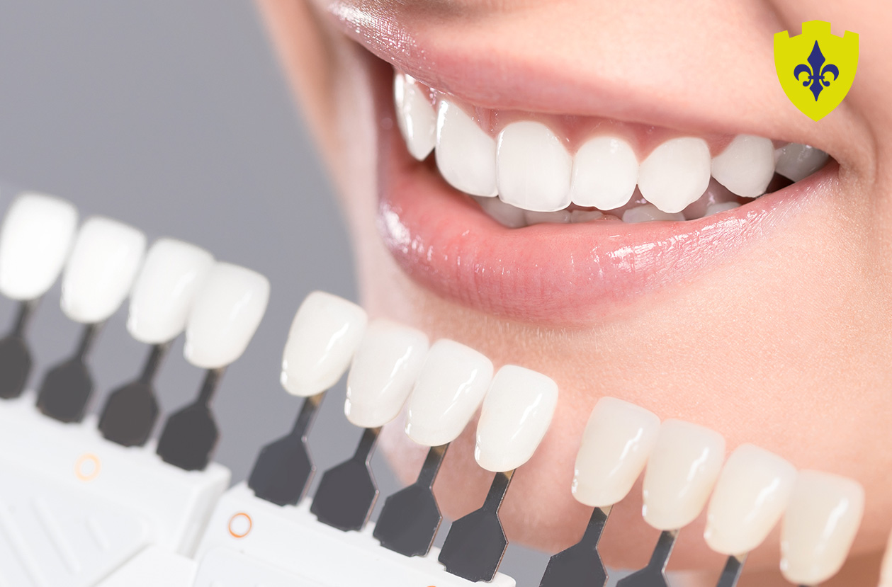 tooth whitening in  Bangor and Newtownards